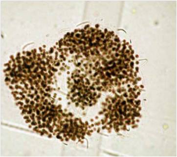 アオコ原因藻類の一つミクロキスティス エルギノーサ