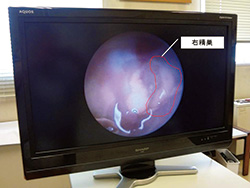 ディスプレイに拡大して映し出すことで、精巣や卵巣の様子が容易に分かる。