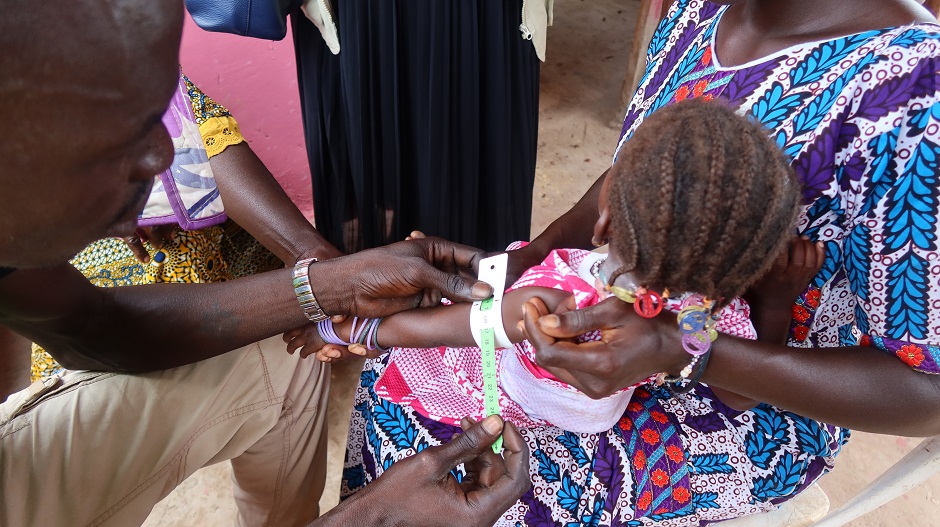 栄養不良のスクリーニング