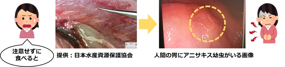 注意せずに食べるとアニサキスによる食中毒になる可能性があります