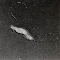 カンピロバクター(電子顕微鏡写真)