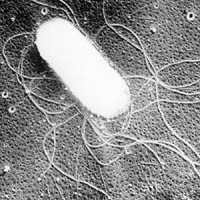 サルモネラ(電子顕微鏡写真)