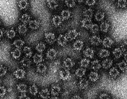 hepatitis_e_virus.jpg