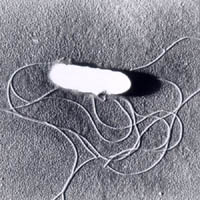 listeria.monocytogenes.jpg