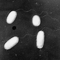 vibrio.parahaemolyticus.jpg