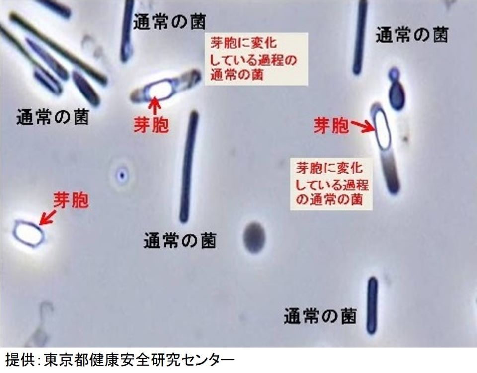 ウェルシュ菌(通常の菌と芽胞)