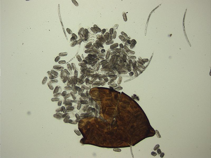 テンサイシストセンチュウ2